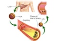 Cover: Estimation of Blood LDL Cholesterol and VLDL Cholesterol - Elsevier