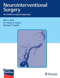 Enlarge image Cover: Neurointerventional Surgery - Thieme Publishers