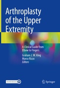 Cover: Arthroplasty of the Upper Extremity - Springer