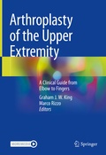 Cover: Arthroplasty of the Upper Extremity - Springer