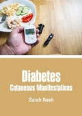 Cover: Diabetes - White Press Academics