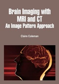 Cover: Brain Imaging with MRI and CT - White Press Academics