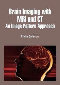Enlarge image Cover: Brain Imaging with MRI and CT - White Press Academics