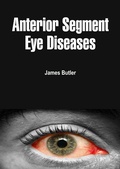 Cover: Anterior Segment Eye Diseases - White Press Academics