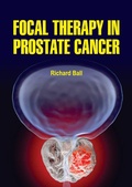 Cover: Focal Therapy in Prostate Cancer - White Press Academics