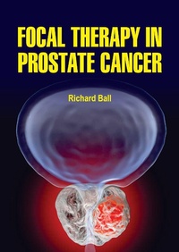 Enlarge image Cover: Focal Therapy in Prostate Cancer - White Press Academics
