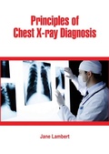 Cover: Principles of Chest X-ray Diagnosis - White Press Academics