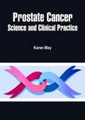 Cover: Prostate Cancer - White Press Academics