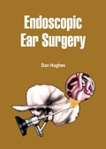 Cover: Endoscopic Ear Surgery - White Press Academics