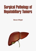 Cover: Surgical Pathology of Hepatobiliary Tumors - White Press Academics
