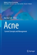 Cover: Acne - Springer