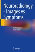 Abbildung von: Neuroradiology - Images vs Symptoms - Springer