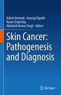 Cover: Skin Cancer: Pathogenesis and Diagnosis - Springer
