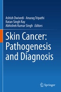 Cover: Skin Cancer: Pathogenesis and Diagnosis - Springer