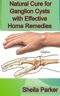 Cover: Natural Cure for Ganglion Cysts with Effective Home Remedies - Lulu.com