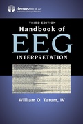 Abbildung von: Handbook of EEG Interpretation, Third Edition - Springer Publishing Company