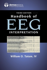 Abbildung von: Handbook of EEG Interpretation, Third Edition - Springer Publishing Company