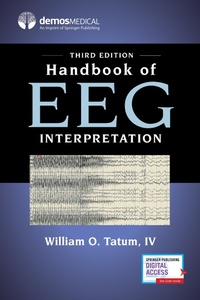 Bild: Handbook of EEG Interpretation - Springer Publishing Company