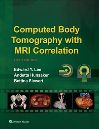 Abbildung von: Computed Body Tomography with MRI Correlation - Wolters Kluwer Health