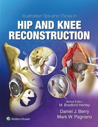 Abbildung von: Illustrated Tips and Tricks in Hip and Knee Reconstructive and Replacement Surgery - Wolters Kluwer Health