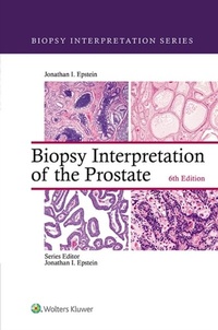 Abbildung von: Biopsy Interpretation of the Prostate - Wolters Kluwer Health