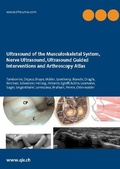 Cover: Ultrasound of the Musculoskeletal System, Nerve Ultrasound, Ultrasound Guided Interventions and Arthroscopy Atlas - BoD - Books on Demand