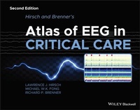 Abbildung von: Hirsch and Brenner's Atlas of EEG in Critical Care - Wiley