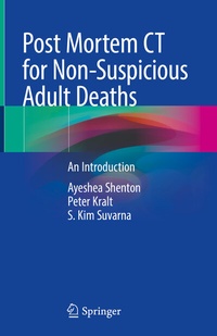 Abbildung von: Post Mortem CT for Non-Suspicious Adult Deaths - Springer