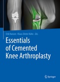 Cover: Essentials of Cemented Knee Arthroplasty - Springer