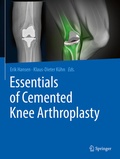 Cover: Essentials of Cemented Knee Arthroplasty - Springer
