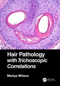 Abbildung von: Hair Pathology with Trichoscopic Correlations - CRC Press