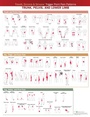 Cover: Travell, Simons & Simons' Trigger Point Pain Patterns Wall Chart - WOLTERS KLUWER HEALTH