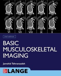 Abbildung von: Basic Musculoskeletal Imaging, Second Edition - McGraw Hill LLC
