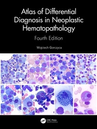Abbildung von: Atlas of Differential Diagnosis in Neoplastic Hematopathology - CRC Press
