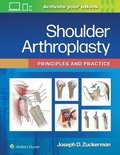 Cover: Shoulder Arthroplasty - WOLTERS KLUWER HEALTH