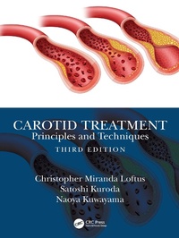 Abbildung von: Carotid Treatment: Principles and Techniques - CRC Press