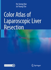 Abbildung von: Color Atlas of Laparoscopic Liver Resection - Springer