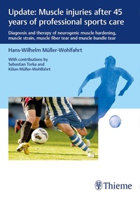 Abbildung von: Update: Muscle injuries after 45 years of professional sports care - Thieme