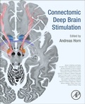 Cover: Connectomic Deep Brain Stimulation - Academic Press
