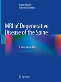 Abbildung von: MRI of Degenerative Disease of the Spine - Springer