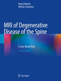 Abbildung von: MRI of Degenerative Disease of the Spine - Springer
