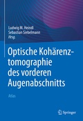 Cover: Optische Koh&auml;renztomographie des vorderen Augenabschnitts - Springer