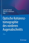 Cover: Optische Koh&auml;renztomographie des vorderen Augenabschnitts - Springer