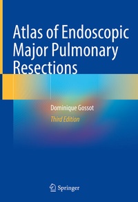 Abbildung von: Atlas of Endoscopic Major Pulmonary Resections - Springer