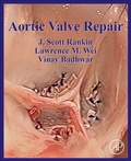 Bild: Aortic Valve Repair - Academic Press