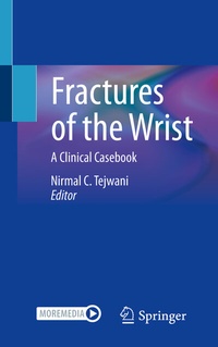 Abbildung von: Fractures of the Wrist - Springer