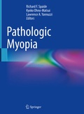 Cover: Pathologic Myopia - Springer