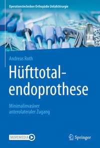 Abbildung von: Hüfttotalendoprothese: minimalinvasiver anterolateraler Zugang - Springer