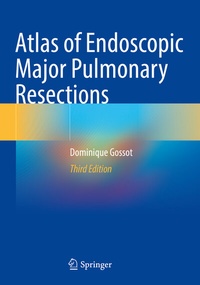 Abbildung von: Atlas of Endoscopic Major Pulmonary Resections - Springer