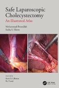 Cover: Safe Laparoscopic Cholecystectomy - CRC Press